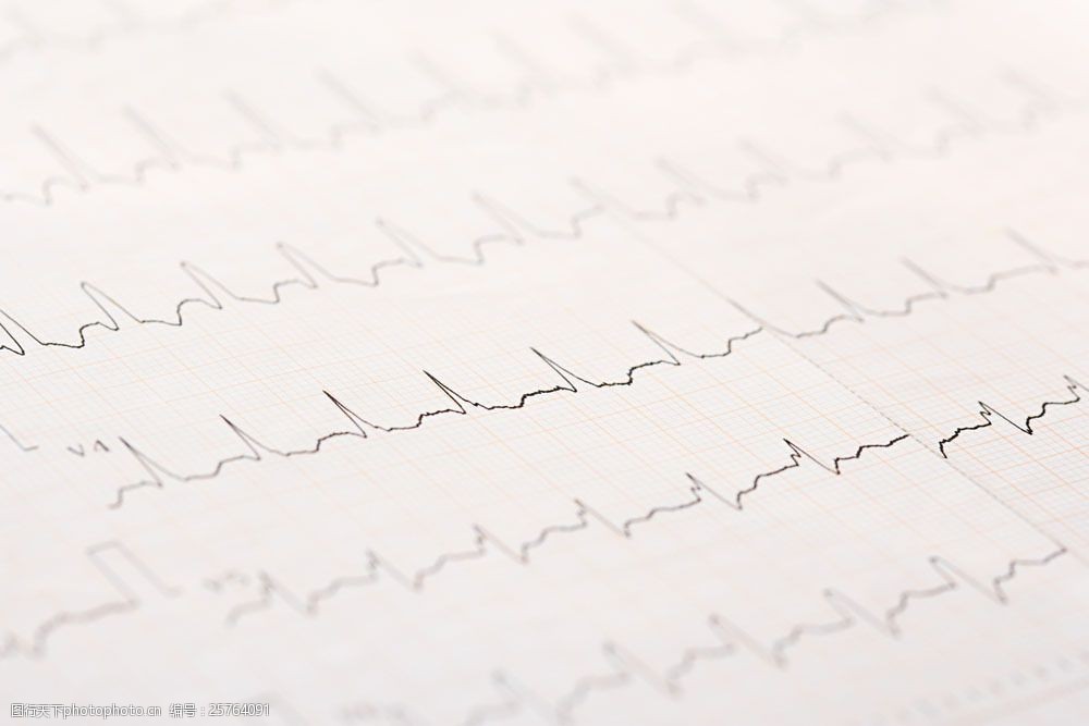 科学技术 关键词:心电图特写摄影图片素材 医院 医疗 心电图 波浪线